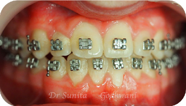 After image