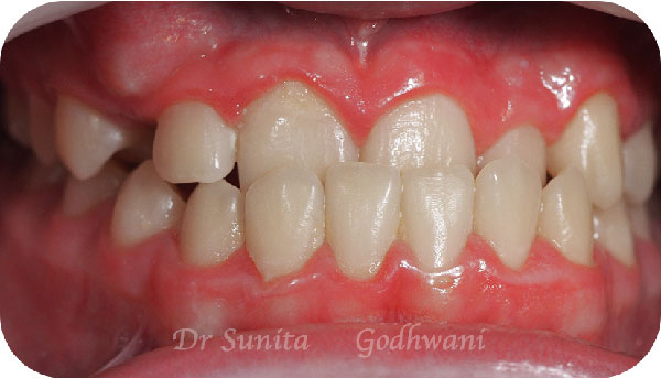 Before image