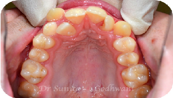Before image