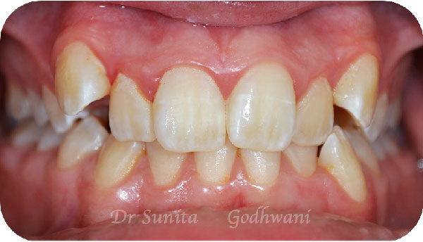 Before image