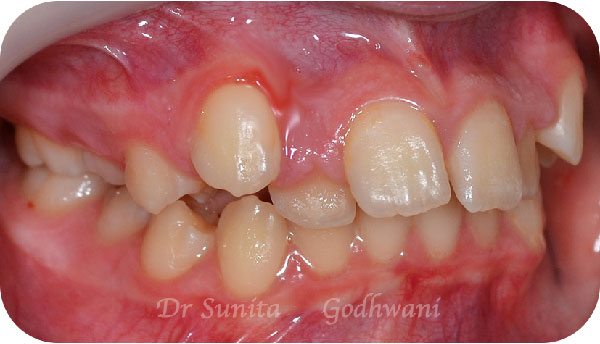 Before image