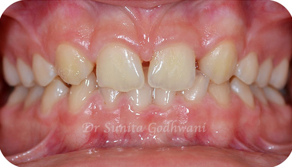 Before image
