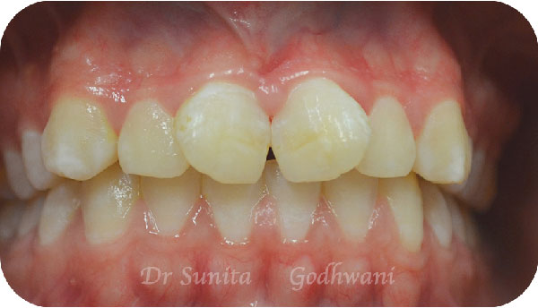 Before image