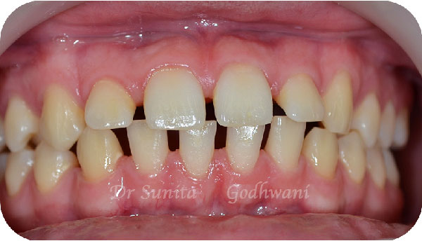 Before image