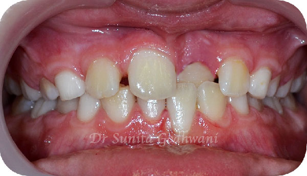 Before image